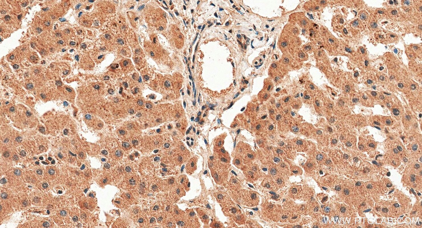 Immunohistochemistry (IHC) staining of human liver tissue using Pirin/PIR Polyclonal antibody (10263-1-AP)