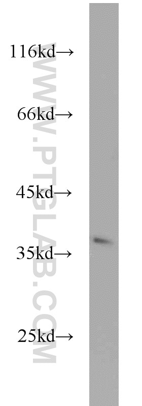 WB analysis of HeLa using 10263-1-AP