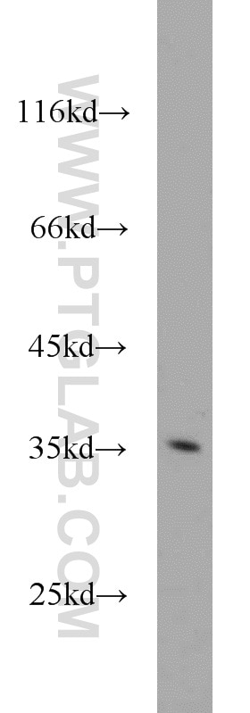 WB analysis of HepG2 using 10263-1-AP