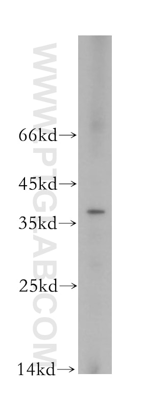 WB analysis of HeLa using 10263-1-AP