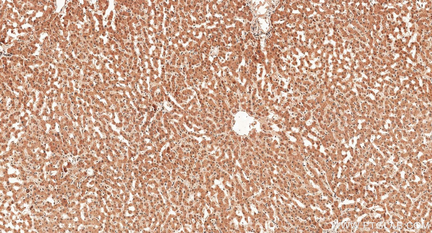 Immunohistochemistry (IHC) staining of human liver tissue using Pirin/PIR Monoclonal antibody (67516-1-Ig)