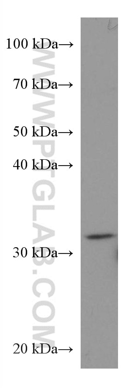 WB analysis of K-562 using 67516-1-Ig