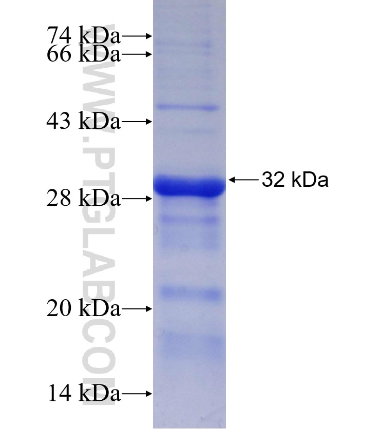 PIR fusion protein Ag29969 SDS-PAGE
