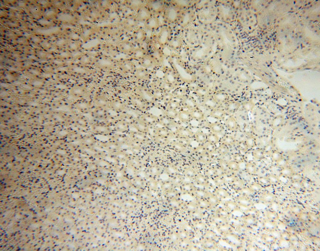 Immunohistochemistry (IHC) staining of human kidney tissue using PISD Polyclonal antibody (16401-1-AP)