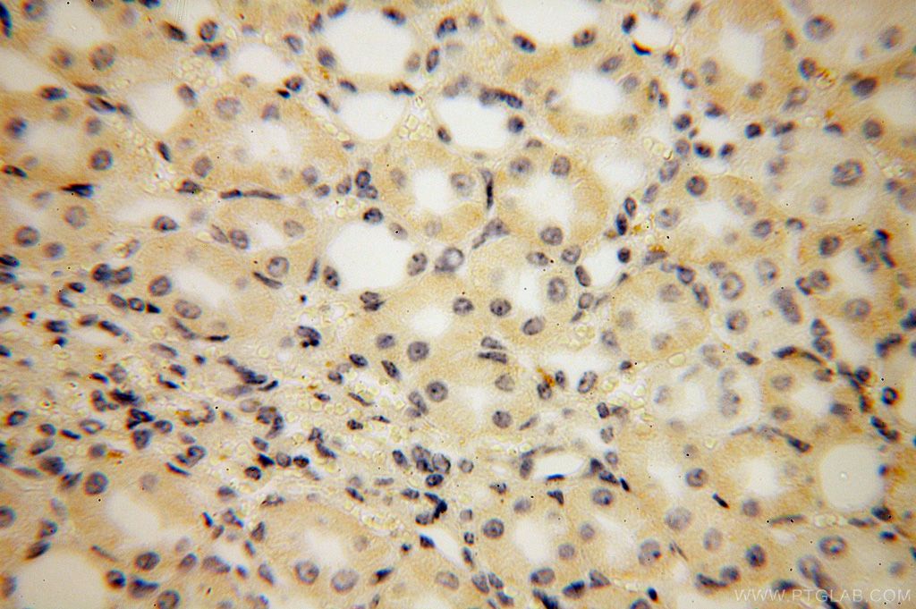 Immunohistochemistry (IHC) staining of human kidney tissue using PISD Polyclonal antibody (16401-1-AP)