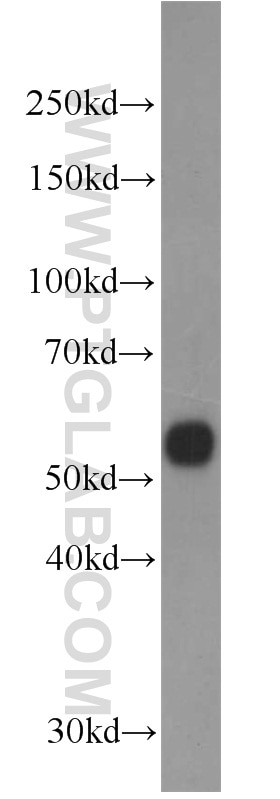 Western Blot (WB) analysis of human spleen tissue using PISD Polyclonal antibody (16401-1-AP)