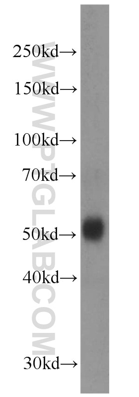 Western Blot (WB) analysis of human kidney tissue using PISD Polyclonal antibody (16401-1-AP)