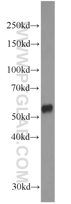 Western Blot (WB) analysis of COLO 320 cells using PISD Polyclonal antibody (16401-1-AP)