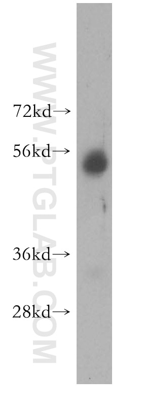 Western Blot (WB) analysis of K-562 cells using PISD Polyclonal antibody (16401-1-AP)