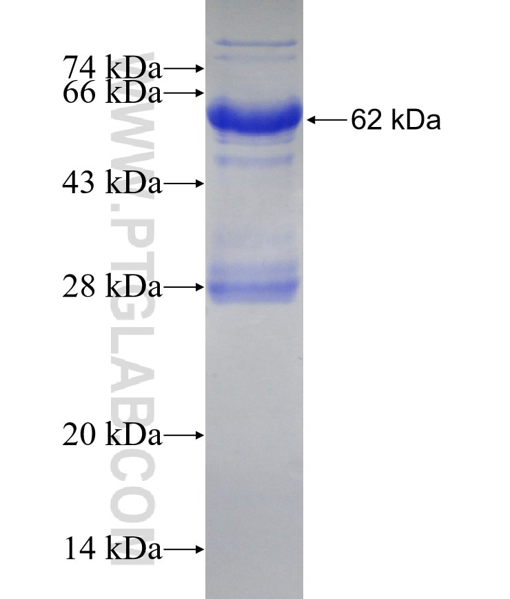 PISD fusion protein Ag9499 SDS-PAGE