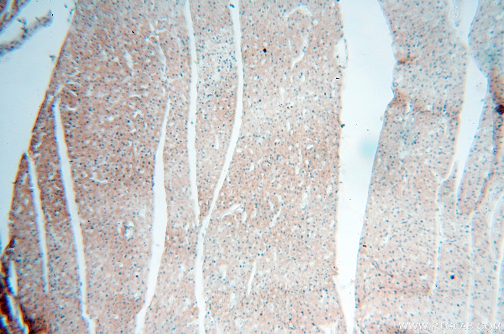 Immunohistochemistry (IHC) staining of human heart tissue using PITPNA Polyclonal antibody (16613-1-AP)