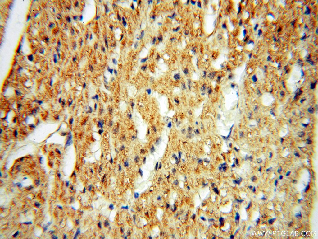 IHC staining of human heart using 16613-1-AP