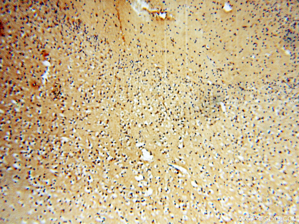 Immunohistochemistry (IHC) staining of human brain tissue using PITPNA Polyclonal antibody (16613-1-AP)