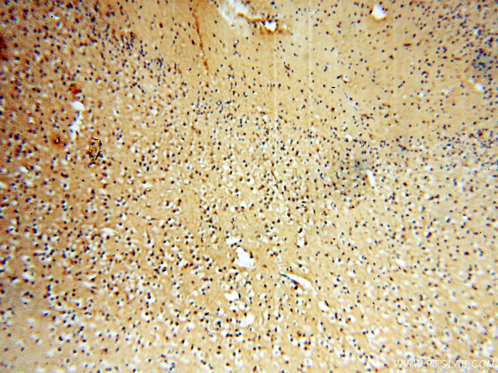 IHC staining of human brain using 16613-1-AP