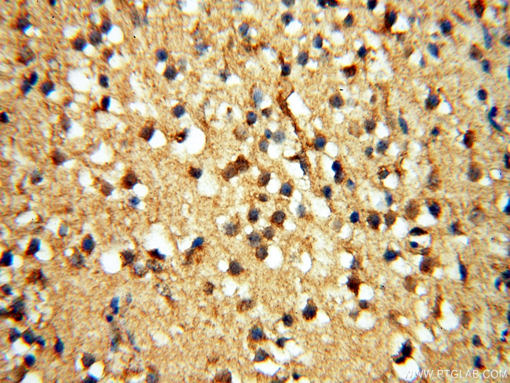 Immunohistochemistry (IHC) staining of human brain tissue using PITPNA Polyclonal antibody (16613-1-AP)