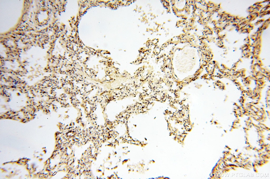 Immunohistochemistry (IHC) staining of human lung tissue using PITPNA Polyclonal antibody (16613-1-AP)