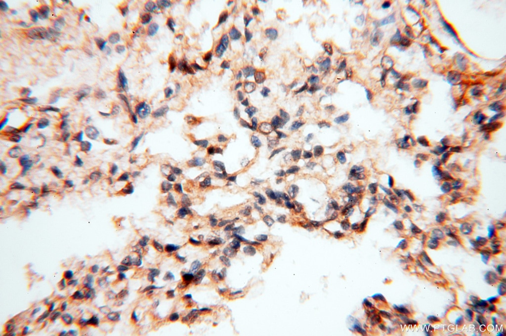 Immunohistochemistry (IHC) staining of human lung tissue using PITPNA Polyclonal antibody (16613-1-AP)