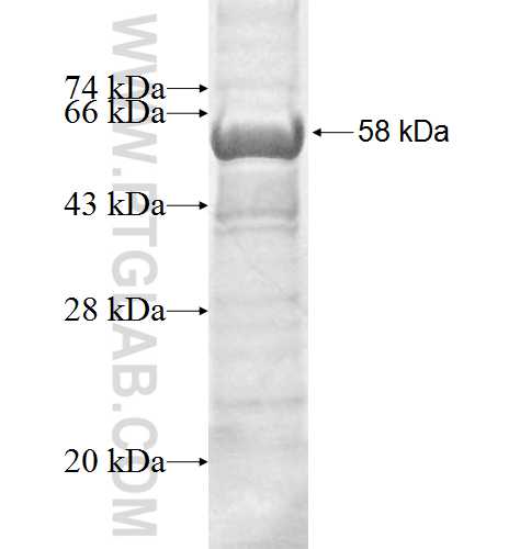 PITPNA fusion protein Ag9849 SDS-PAGE