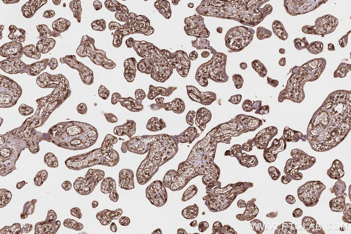 Immunohistochemistry (IHC) staining of human placenta tissue using PITPNB Polyclonal antibody (13110-1-AP)