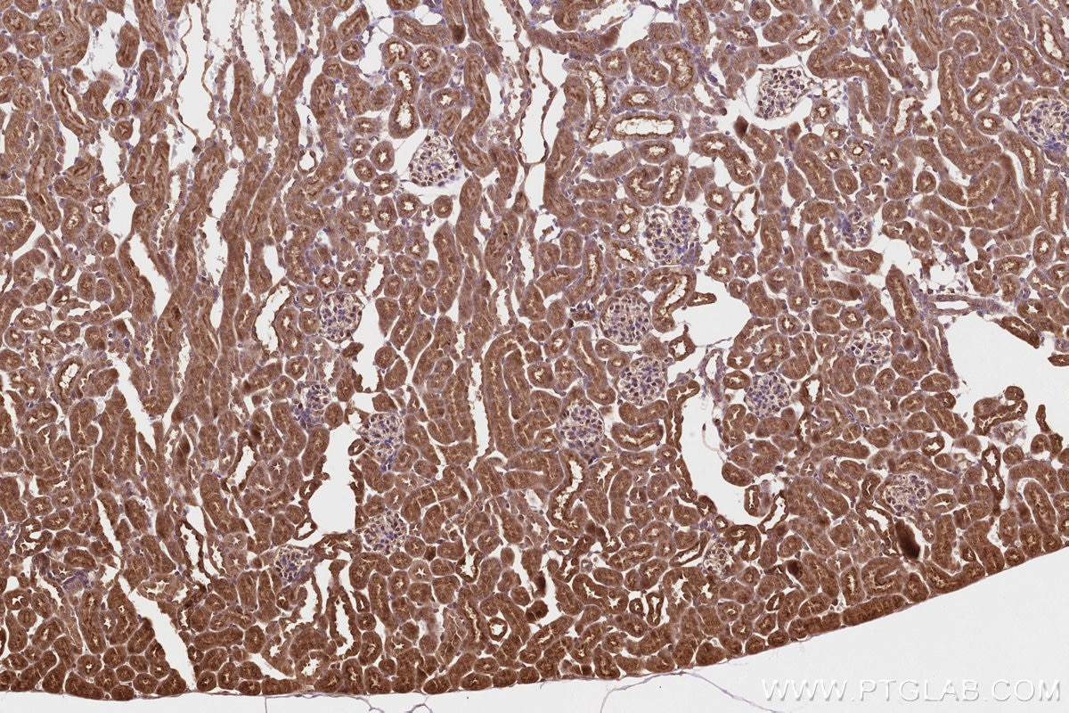 Immunohistochemistry (IHC) staining of mouse kidney tissue using PITPNB Polyclonal antibody (13110-1-AP)