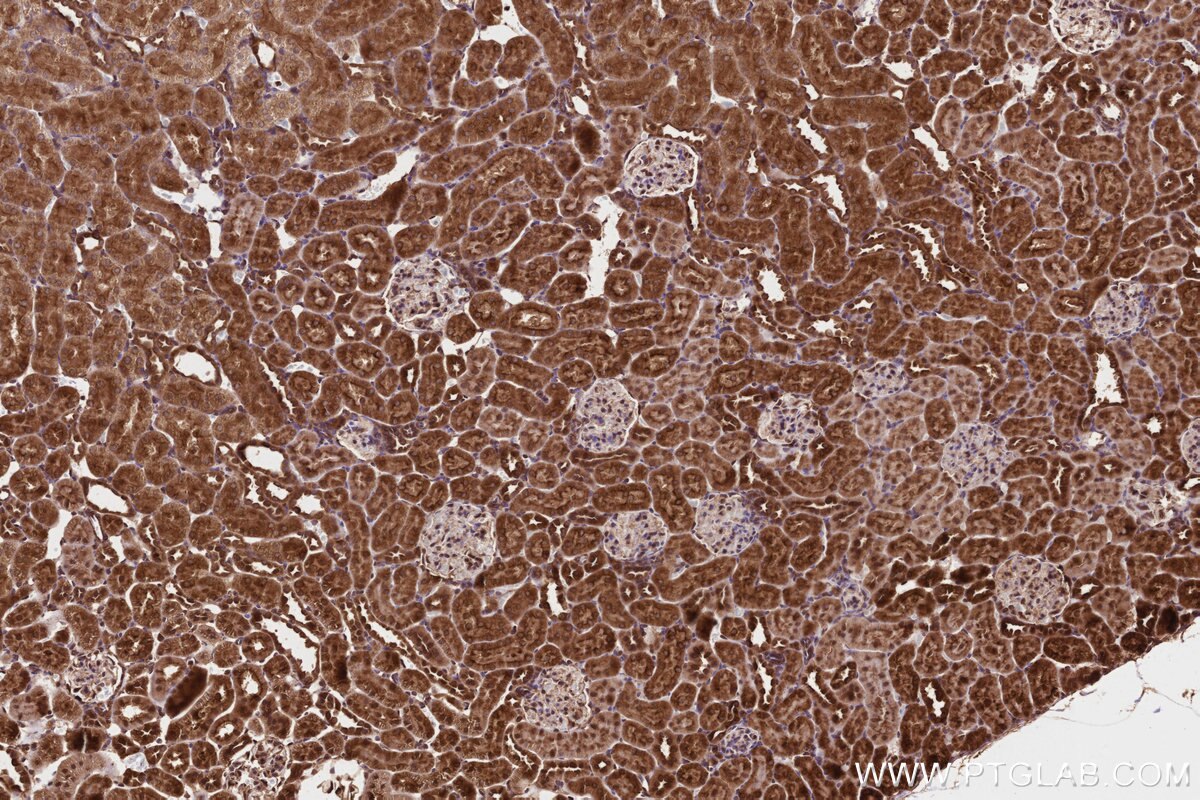Immunohistochemistry (IHC) staining of rat kidney tissue using PITPNB Polyclonal antibody (13110-1-AP)