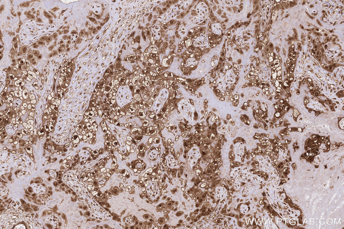 Immunohistochemistry (IHC) staining of human placenta tissue using PITPNB Polyclonal antibody (13110-1-AP)