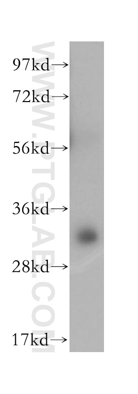 Western Blot (WB) analysis of HeLa cells using PITPNB Polyclonal antibody (13110-1-AP)