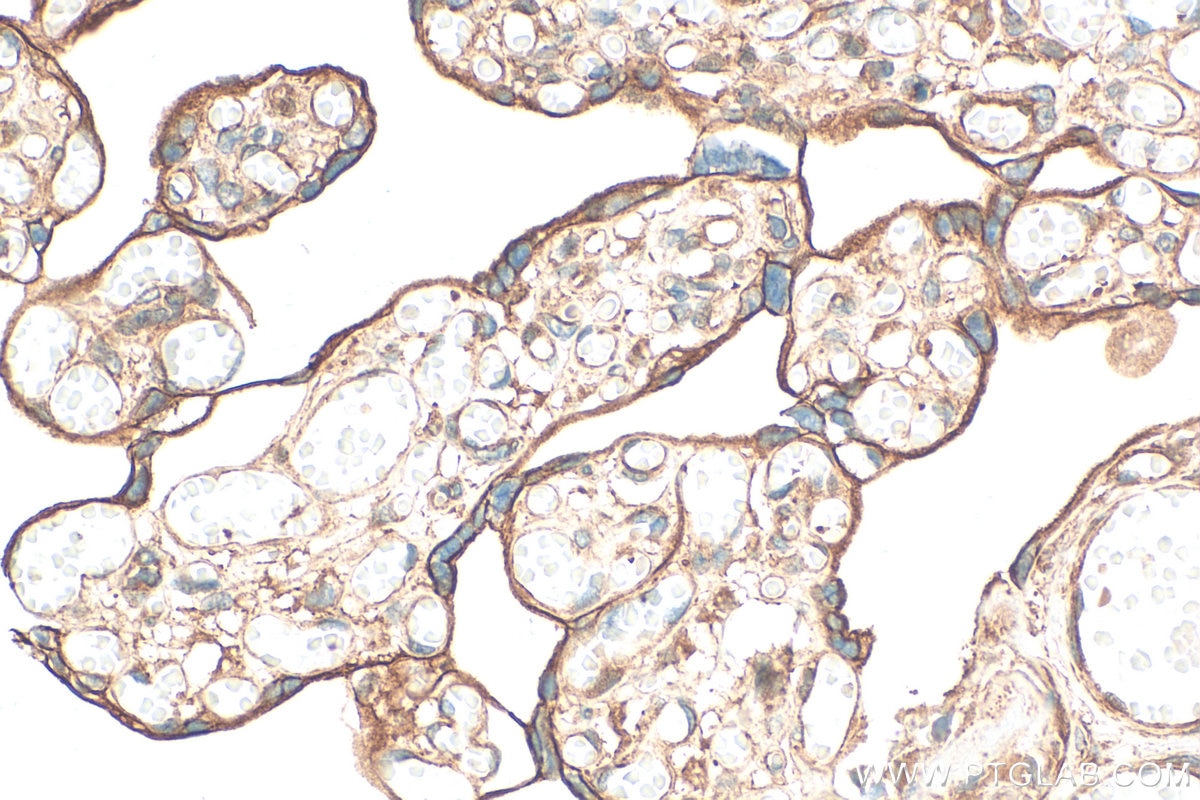 Immunohistochemistry (IHC) staining of human placenta tissue using PITPNM2/NIR3 Polyclonal antibody (21169-1-AP)