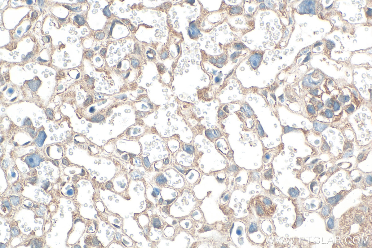 Immunohistochemistry (IHC) staining of mouse placenta tissue using PITPNM2/NIR3 Polyclonal antibody (21169-1-AP)