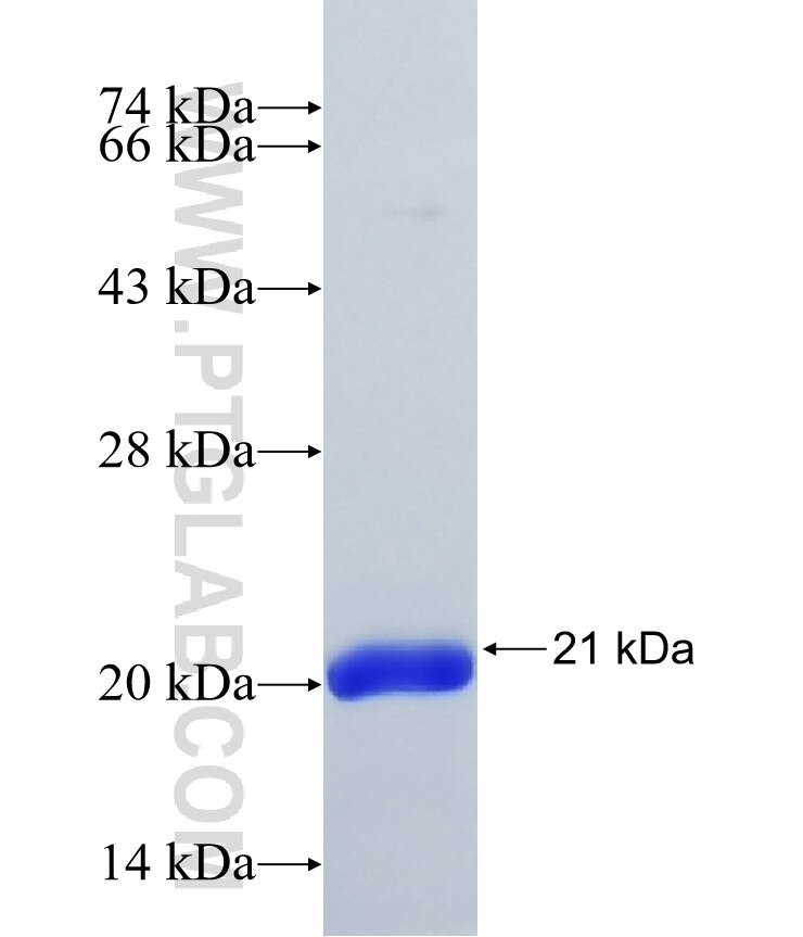 PITPNM2 fusion protein Ag16535 SDS-PAGE