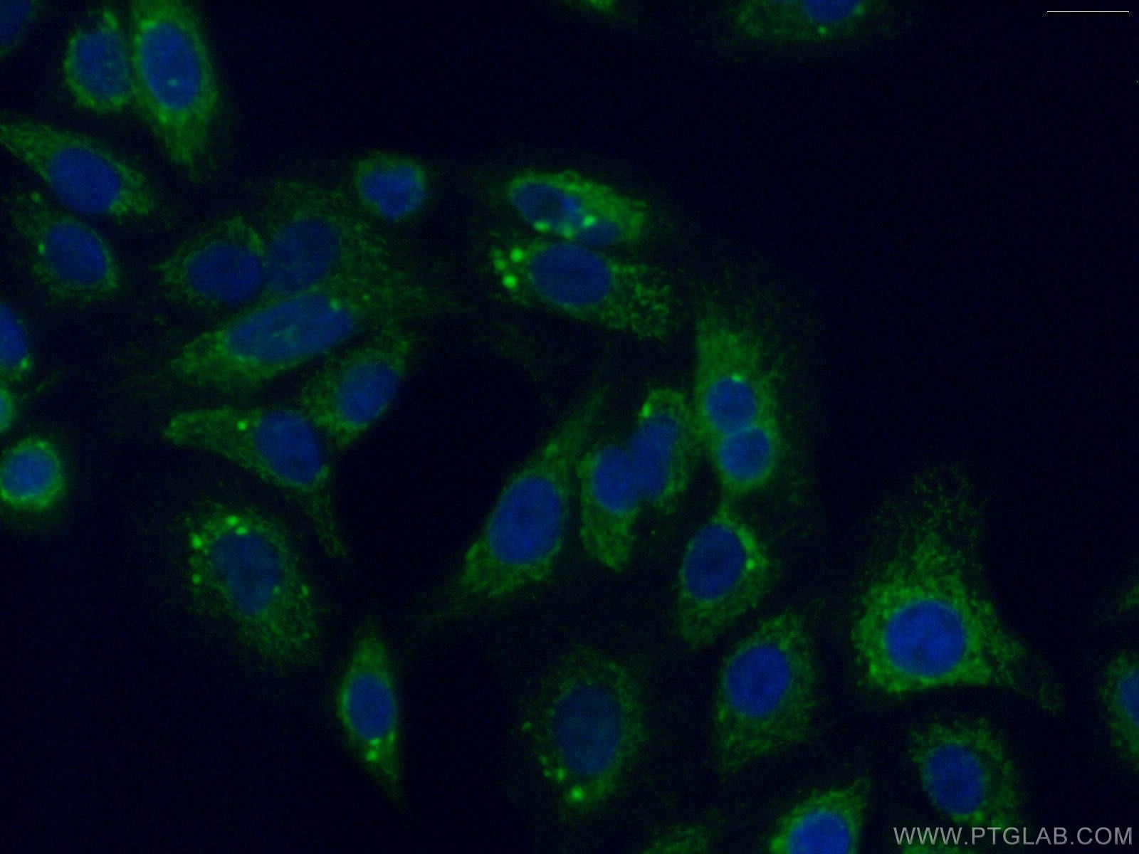 Immunofluorescence (IF) / fluorescent staining of A549 cells using PITRM1 Polyclonal antibody (10101-2-AP)