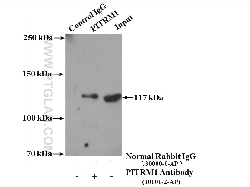 Immunoprecipitation (IP) experiment of A549 cells using PITRM1 Polyclonal antibody (10101-2-AP)