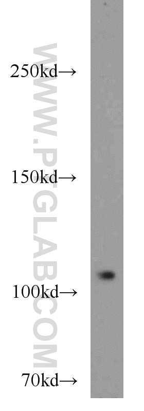 Western Blot (WB) analysis of mouse testis tissue using PITRM1 Polyclonal antibody (10101-2-AP)