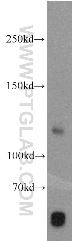 Western Blot (WB) analysis of human placenta tissue using PITRM1 Polyclonal antibody (10101-2-AP)