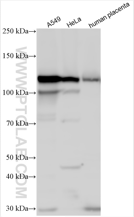 Western Blot (WB) analysis of various lysates using PITRM1 Polyclonal antibody (30674-1-AP)