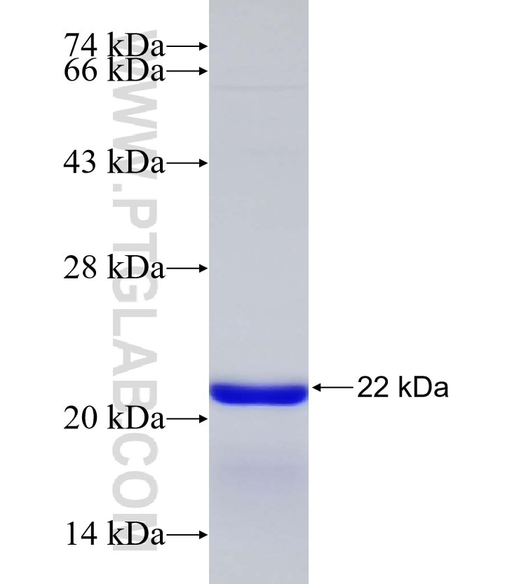 PITRM1 fusion protein Ag30478 SDS-PAGE