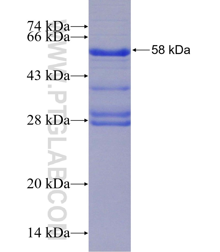 PITRM1 fusion protein Ag0150 SDS-PAGE