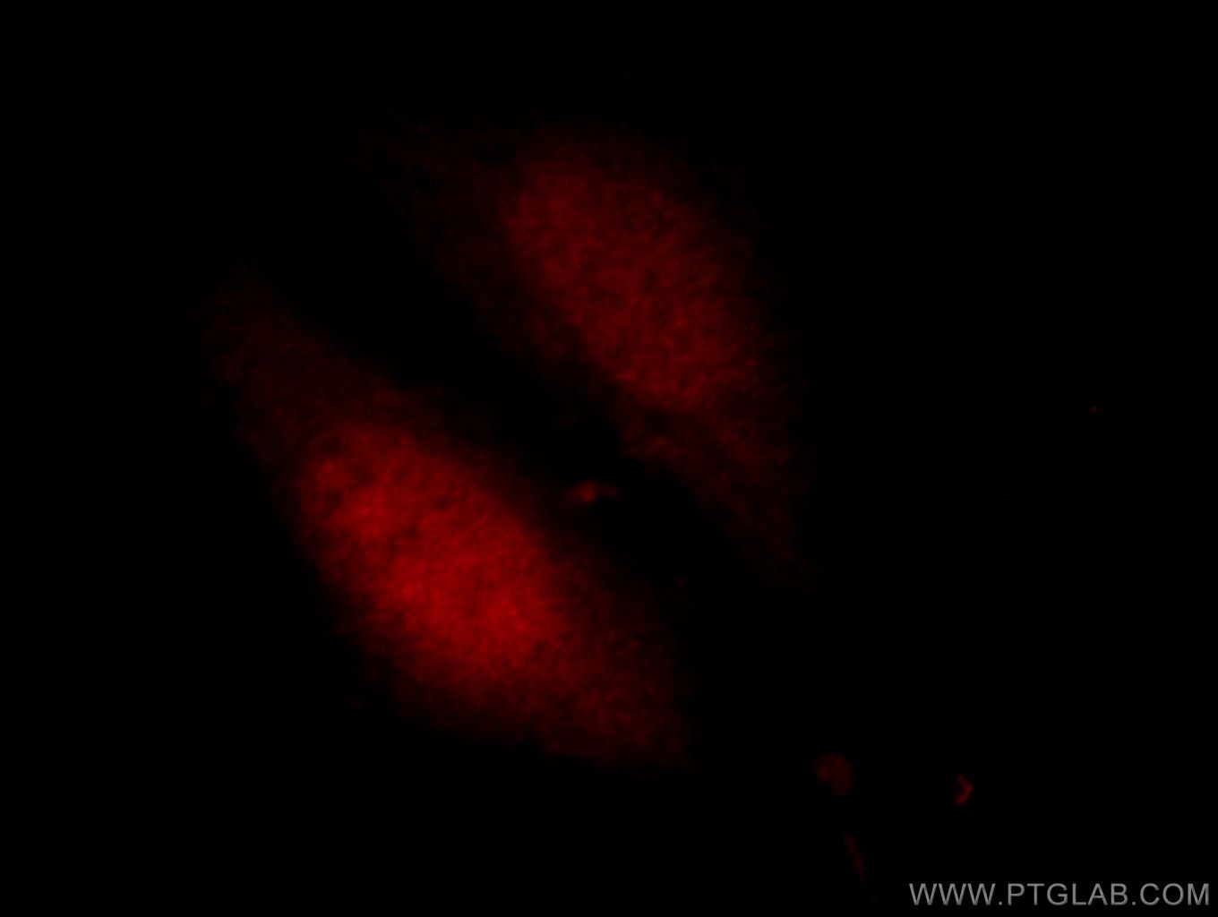 Immunofluorescence (IF) / fluorescent staining of HepG2 cells using PITX1 Polyclonal antibody (10873-1-AP)