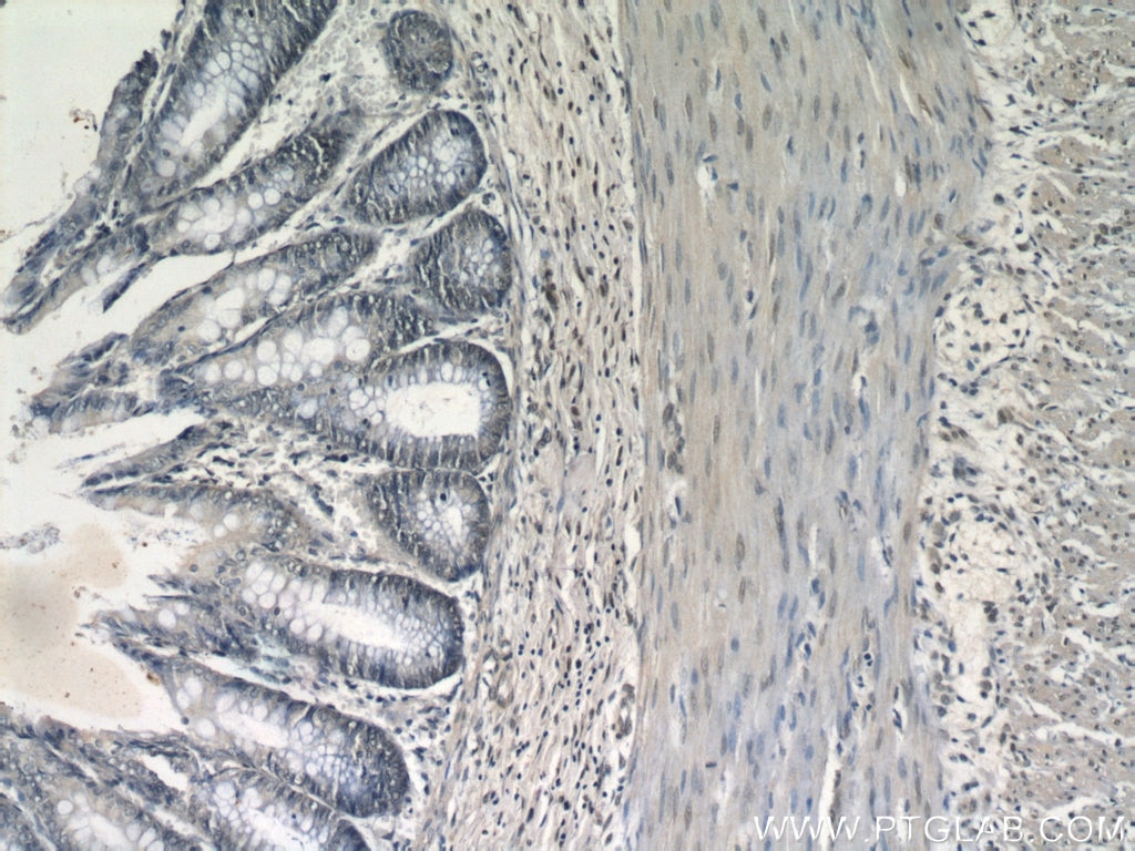 Immunohistochemistry (IHC) staining of human colon tissue using PITX1 Polyclonal antibody (10873-1-AP)