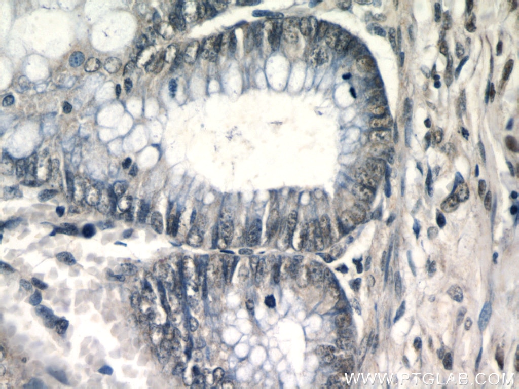 Immunohistochemistry (IHC) staining of human colon tissue using PITX1 Polyclonal antibody (10873-1-AP)