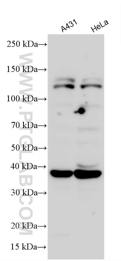 Western Blot (WB) analysis of various lysates using PITX1 Polyclonal antibody (10873-1-AP)