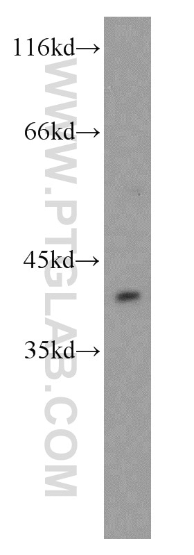Western Blot (WB) analysis of A431 cells using PITX1 Polyclonal antibody (10873-1-AP)