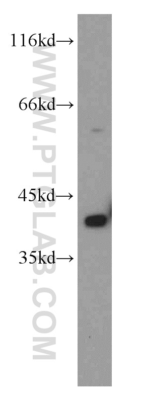 Western Blot (WB) analysis of A431 cells using PITX1 Polyclonal antibody (10873-1-AP)