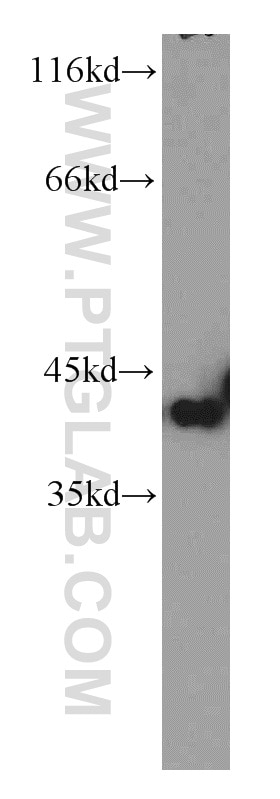 Western Blot (WB) analysis of MCF-7 cells using PITX1 Polyclonal antibody (10873-1-AP)