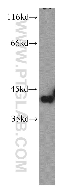 WB analysis of MCF-7 using 10873-1-AP