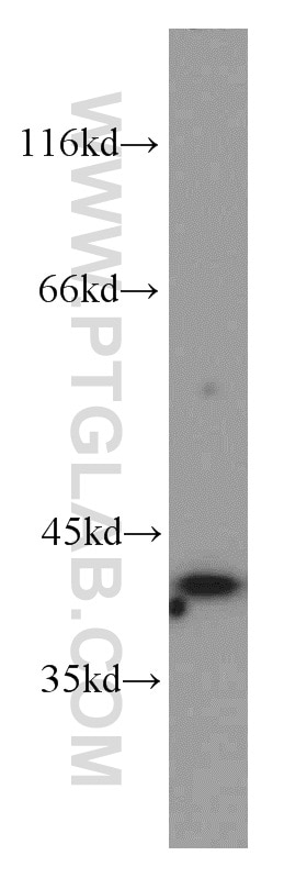 Western Blot (WB) analysis of HeLa cells using PITX1 Polyclonal antibody (10873-1-AP)
