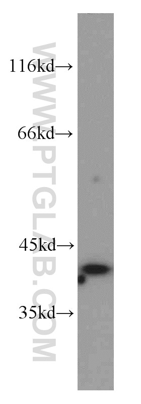 WB analysis of HeLa using 10873-1-AP