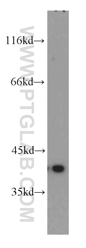 Western Blot (WB) analysis of HeLa cells using PITX1 Polyclonal antibody (10873-1-AP)