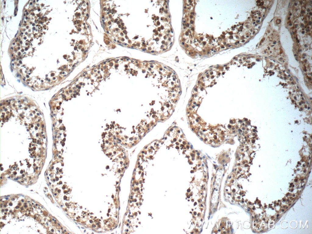 Immunohistochemistry (IHC) staining of human testis tissue using PIWIL1 Polyclonal antibody (15659-1-AP)