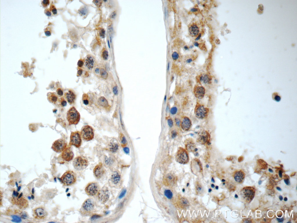 Immunohistochemistry (IHC) staining of human testis tissue using PIWIL1 Polyclonal antibody (15659-1-AP)